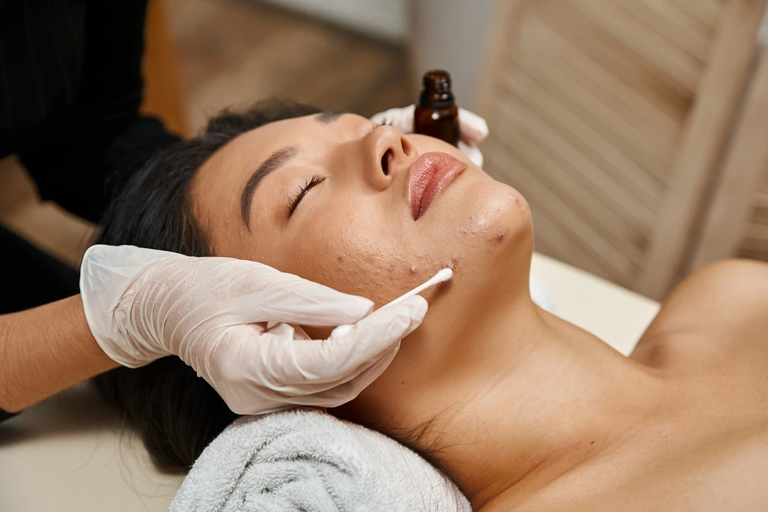 acne facial service phoenix, facial for acne-prone skin, clear skin facial phoenix, best acne treatment facial, facial for blackheads and oily skin, acne scar facial phoenix